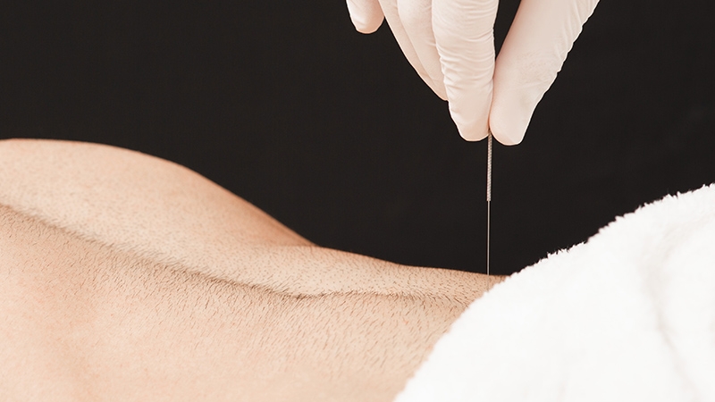 椎間盤突出、坐骨神經痛